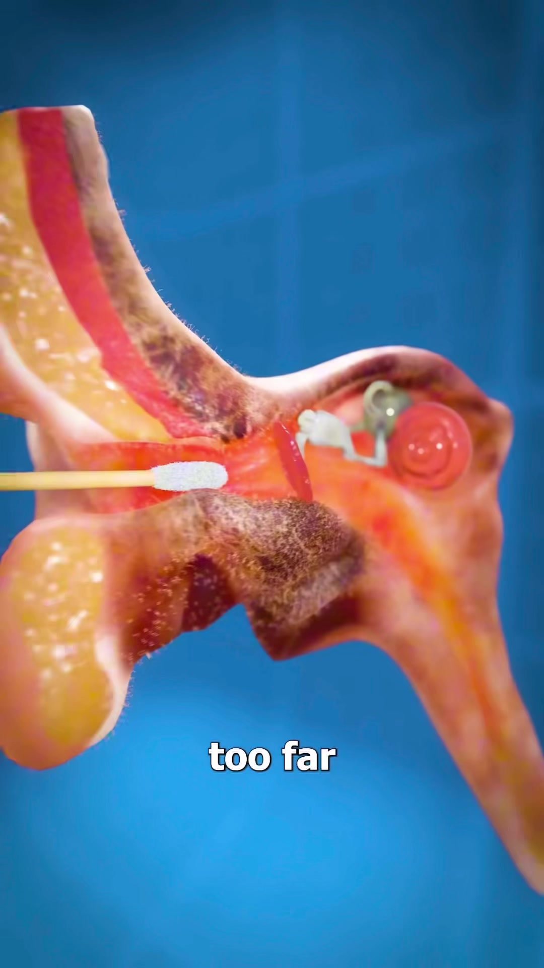 If you stick a Q-tip
too far into your ear
you can actually 